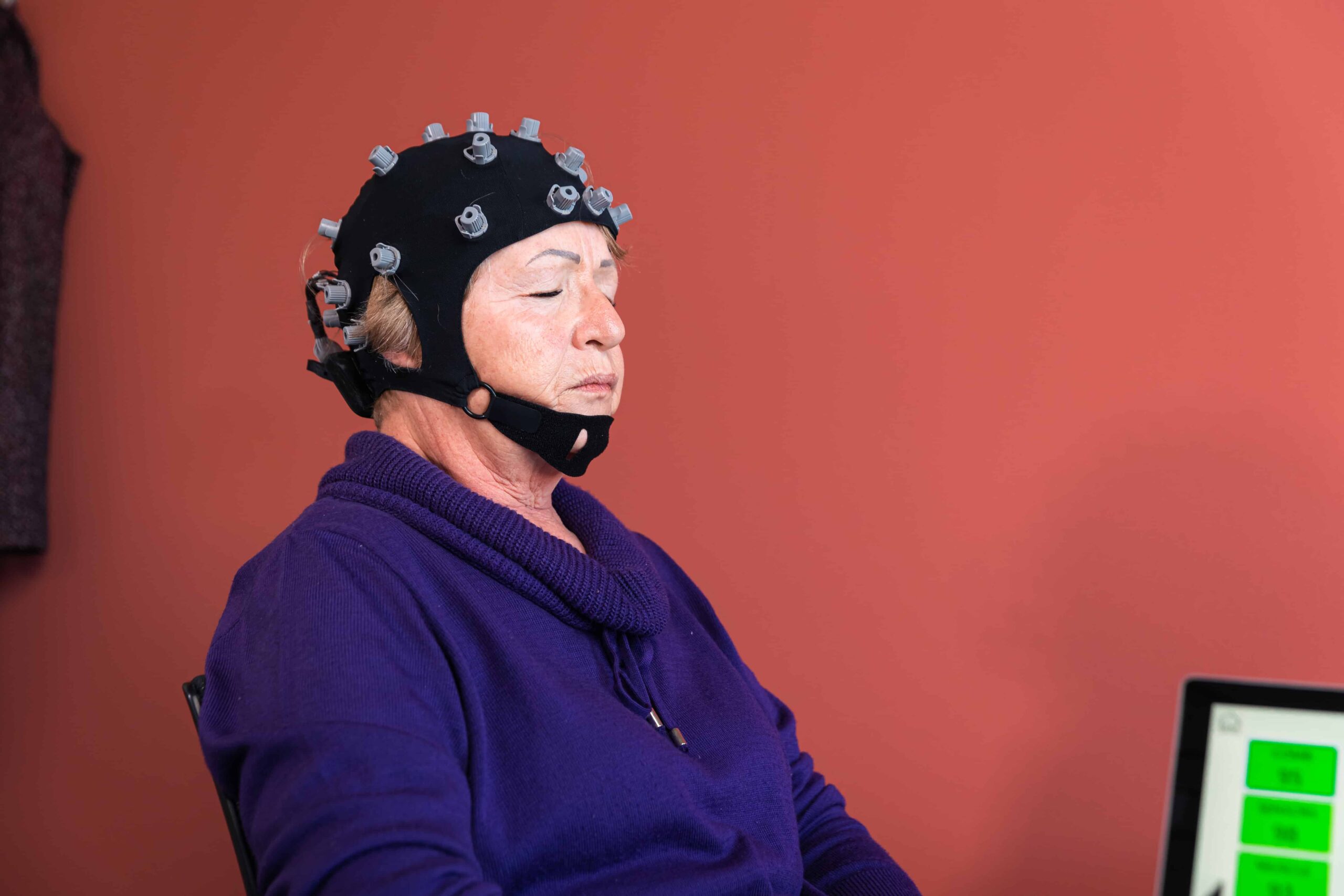 Breakthrough in early detection of dementia through analysis of millions of brain scans