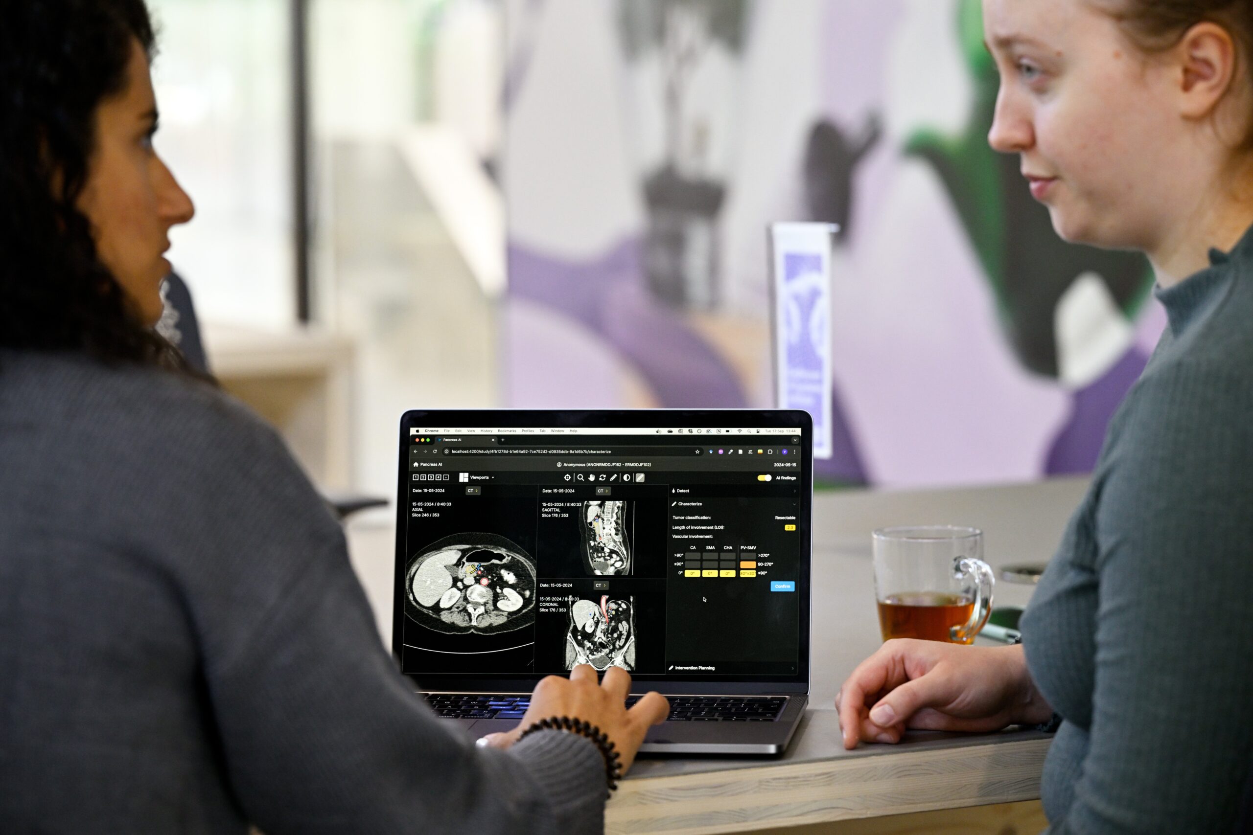 Using AI for cancer treatment: ‘Not just scientific research, but a personal mission’
