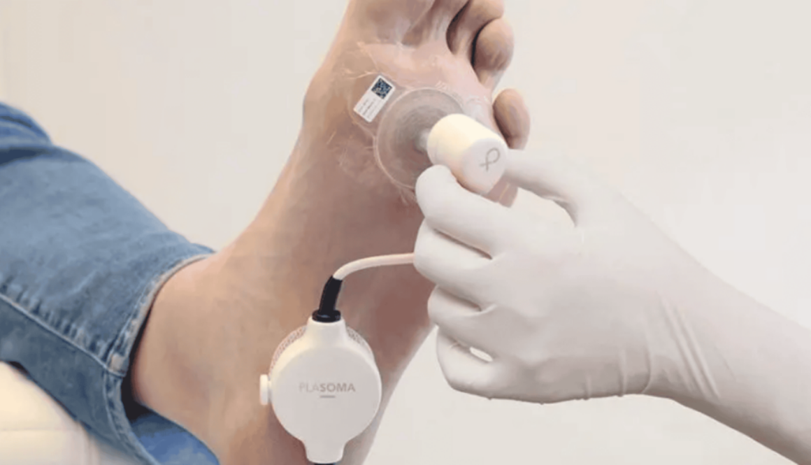 Dutch hospital leverages AI for faster detection of lung cancer 